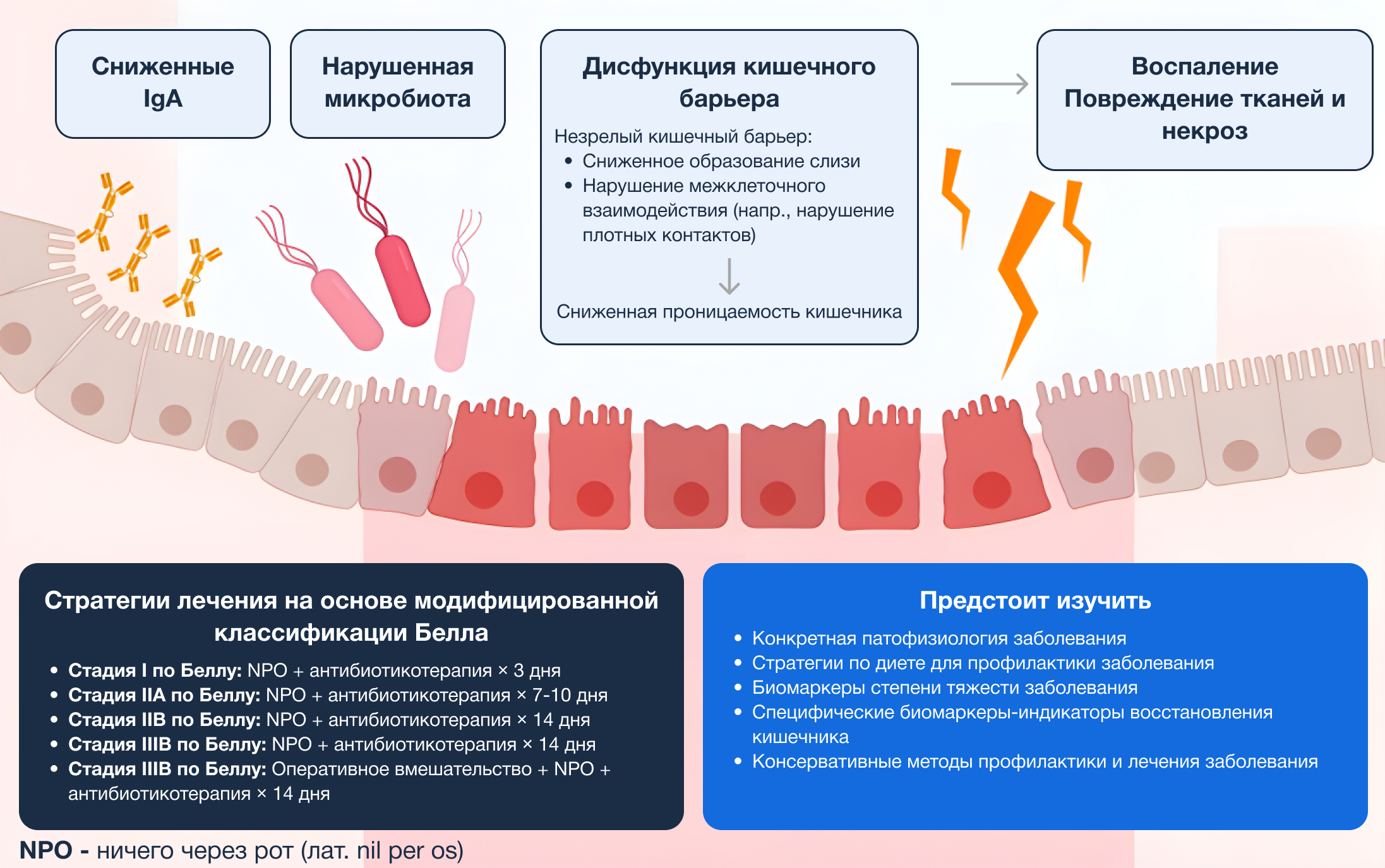 База знаний | Некротизирующий энтероколит новорожденных